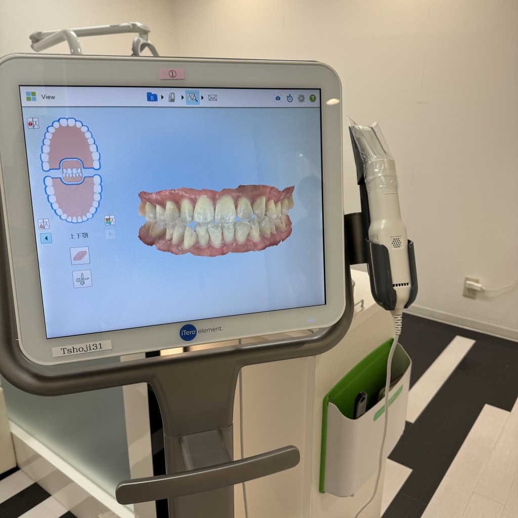 カウンセリング　精密検査　3Ｄスキャナー　歯列矯正