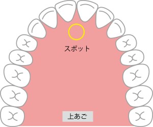 MFT　舌　滑舌　スポットポジション