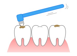 タフトブラシとは タフトブラシ使用方法 歯ブラシと使い分け