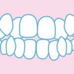 歯並び 凸凹歯並び　叢生　ガチャ歯　乱杭歯　改善方法　矯正治療
