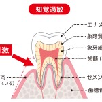 歯が痛い　知覚過敏　歯ぎしり　親知らずの影響